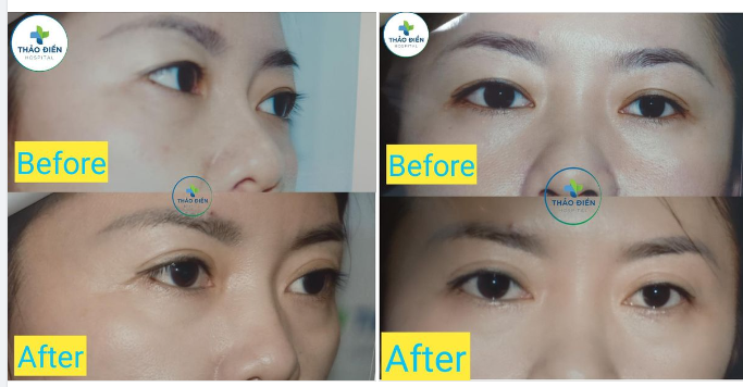 Cơm Lam Phải Chấm Muối Vừng. Mê" LÀM ĐẸP "Là Phải Nói Chứ đừng có giấu nha
