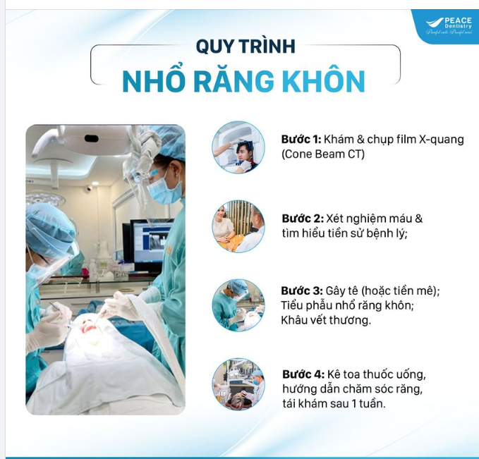 NHỔ RĂNG KHÔN NHẸ NHÀNG, AN TOÀN TẠI PEACE DENTISTRY