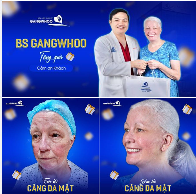 Bệnh viện Gangwhoo cảm ơn khách hàng căng da mặt