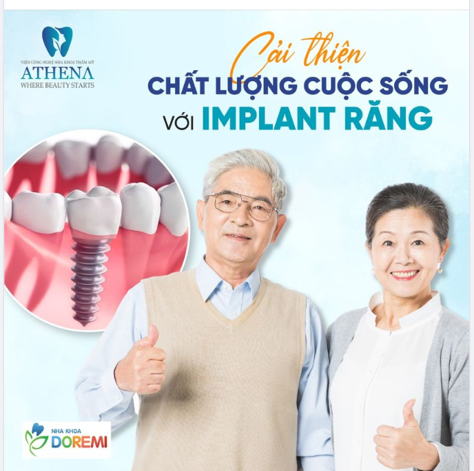 Cải Thiện Cuộc Sống Với Implant - Giải Pháp Vững Chắc Cho Hàm Răng