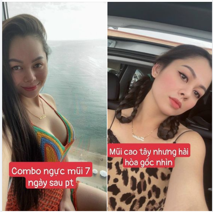 COMBO NÂNG CẤP VÒNG 1 - SỬA MŨI CẤU TRÚC- NÂNG CẤP CUỘC ĐỜI