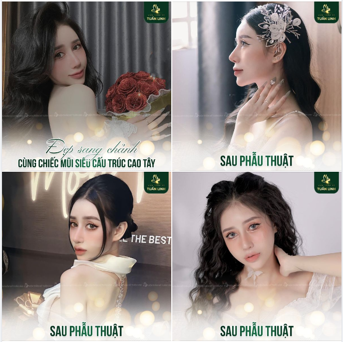 Đẹp sang chảnh cùng chiếc mũi siêu cấu trúc cao tây