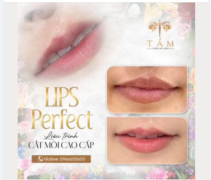 LIPS PERFECT - Tạo đôi môi tim quyến rũ vạn người mê