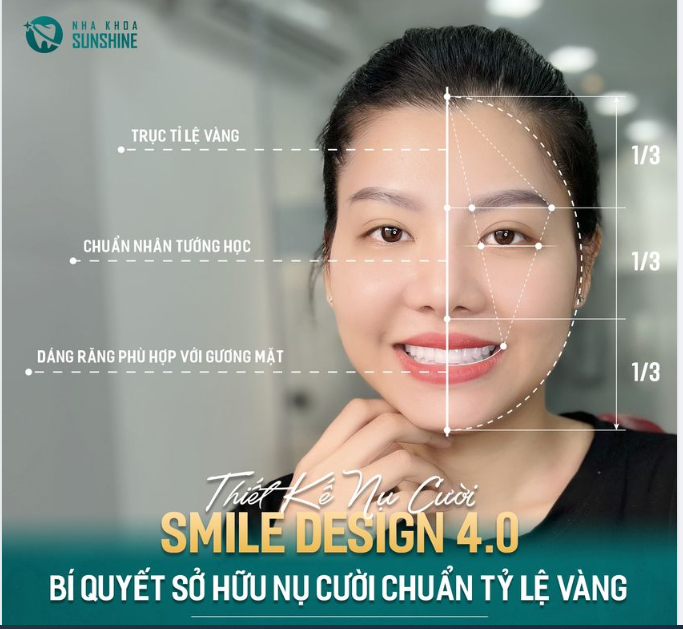SỞ HỮU NỤ CƯỜI CHUẨN TỶ LỆ VÀNG VỚI CÔNG NGHỆ SMILE DESIGN 4.0