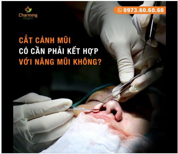 CẮT CÁNH MŨI CÓ PHẢI LÀM CHUNG VỚI PHẪU THUẬT NÂNG MŨI KHÔNG?