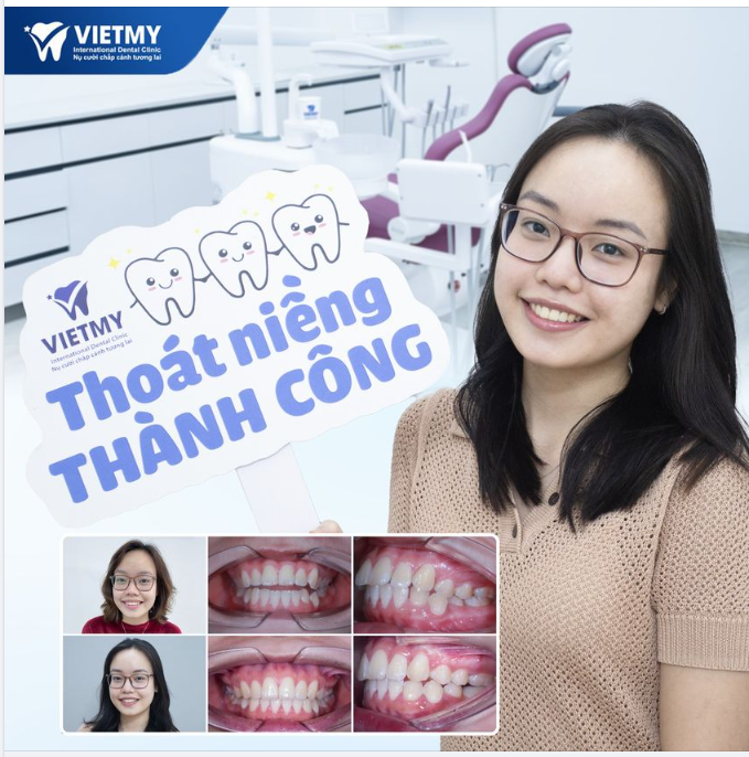 Hành trình niềng răng của bạn Thu Ngân tại Nha Khoa Quốc Tế Việt Mỹ.