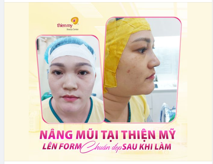 Lên feedback cho KH có động lực làm đẹp nè!