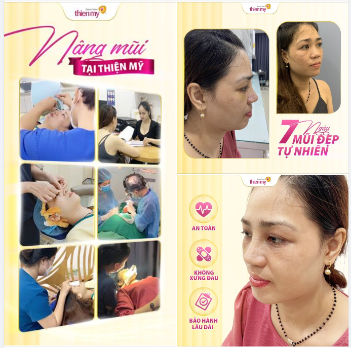 Đây là lý do Thiện Mỹ không cần quảng cáo quá rầm rộ mà KH vẫn kéo đến ầm ầm!