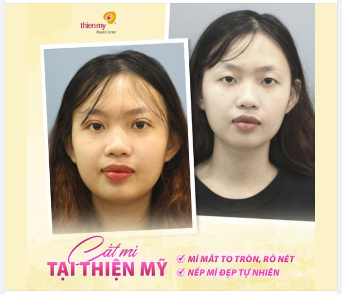 MÍ ĐẸP MẮT SANG –THẦN THÁI NGÚT NGÀN