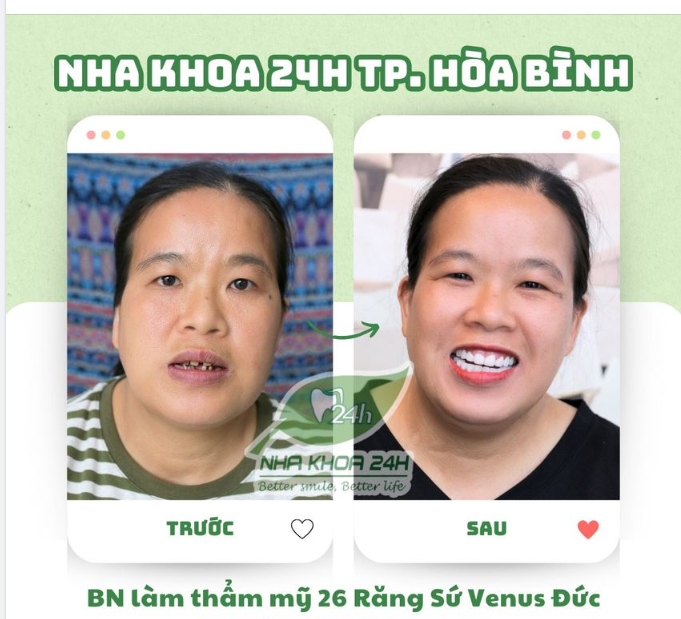 CƠ HỘI CUỐI CÙNG NHẬN ƯU ĐÃI THÁNG 10