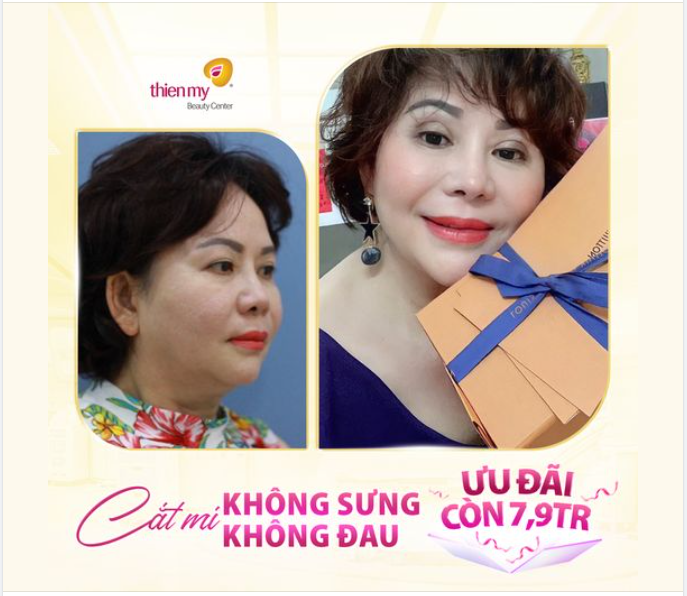 MÍ XINH MẮT ĐẸP GIÁ “CHẤT” CHƯA TỪNG CÓ TẠI THIỆN MỸ