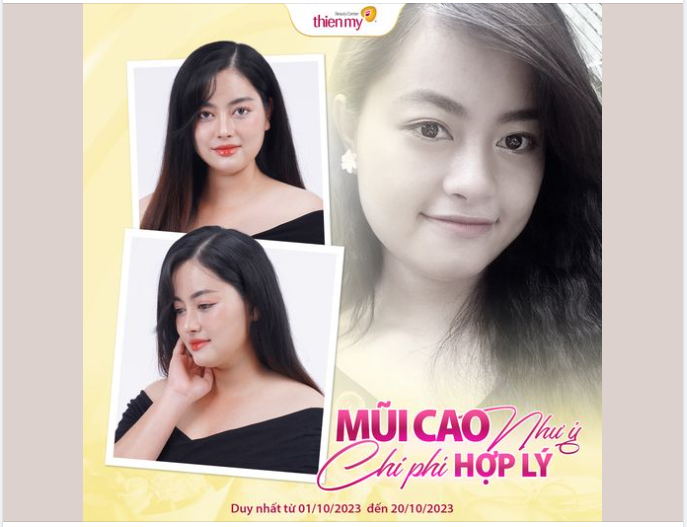 MŨI CAO MẶT XINH - THẦN THÁI CUỐN HÚT