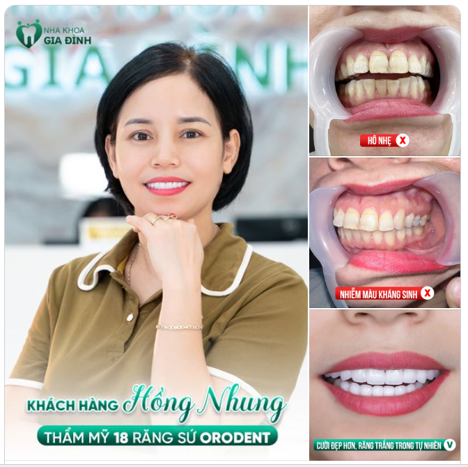 ĐẰNG SAU NỤ CƯỜI RẠNG NGỜI LÀ CẢ MỘT SỰ QUYẾT TÂM