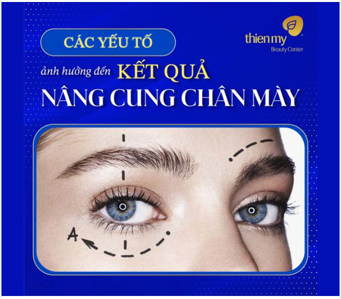CÁC YẾU TỐ ẢNH HƯỞNG ĐẾN KẾT QUẢ NÂNG CUNG CHÂN MÀY
