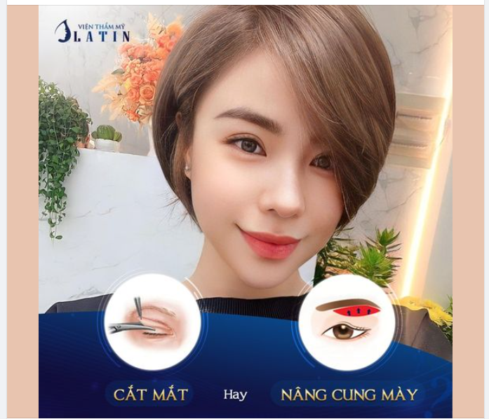 Cắt da mỡ thừa mí trên hay Nâng cung chân mày - Lựa chọn nào là tốt nhất?