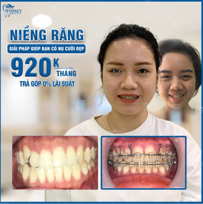 TUẦN LỄ VÀNG TẶNG NÀNG CỰC NHIỀU ƯU ĐÃI!