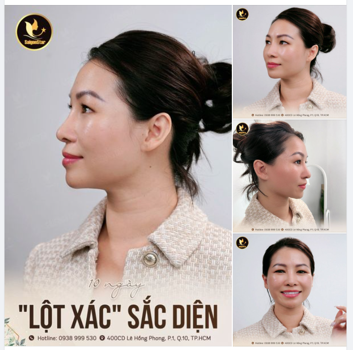 10 NGÀY LỘT XÁC SẮC DIỆN
