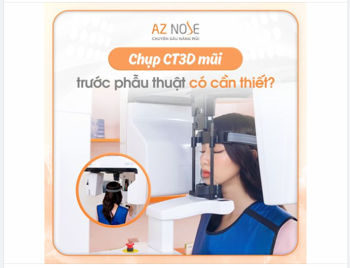 CHỤP CT3D MŨI TRƯỚC PHẪU THUẬT CÓ CẦN THIẾT?