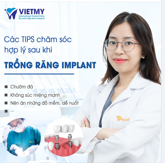 Tận hưởng nụ cười hoàn hảo sau khi cấy implant với những Tips Chăm Sóc Răng Đúng Cách!