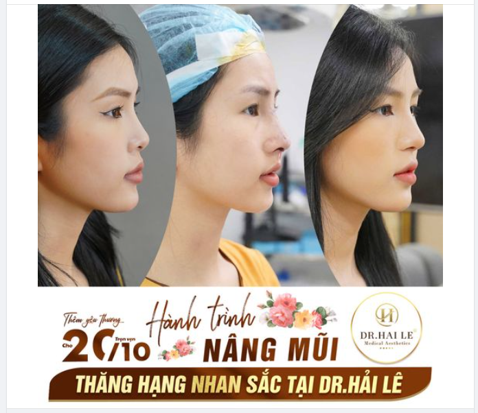  Từ bé, tôi đã ước mơ được làm người nổi tiếng. Lớn hơn một chút, tôi trở thành người mẫu ảnh. Nhưng khi thực sự đi làm rồi tôi chợt phát hiện, góc nghiêng của bản thân không hề đẹp.