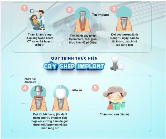 TRỒNG RĂNG IMPLANT 1 LẦN - YÊN TÂM DÙNG CẢ ĐỜI