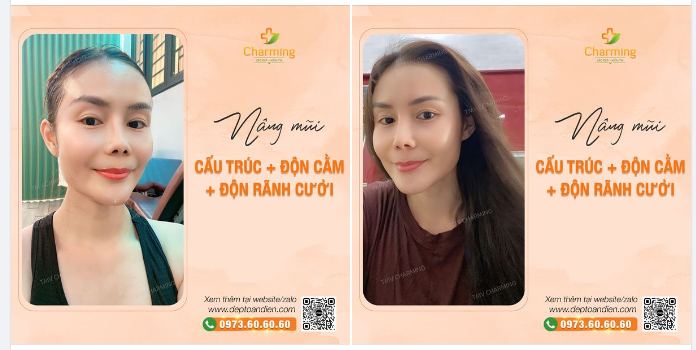 Nếu độc thân là một môn thể thao, bạn đoán mình xứng đáng được huy chương nào?