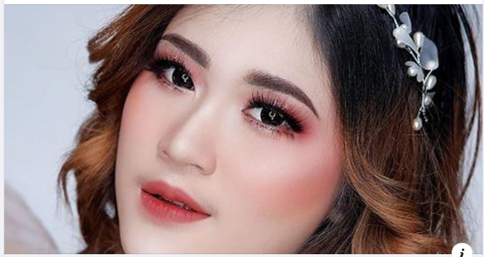 Lấy mỡ mí mắt tuy chỉ là tiểu phẫu đơn giản nhưng cũng có rất nhiều khách hàng còn lưỡng lự vì không biết việc lấy mỡ mí mắt có bị biến chứng không.