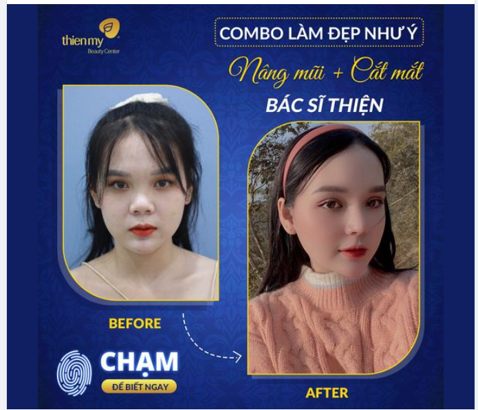 SỞ HỮU GÓC NGHIÊNG THẦN THÁNH VỚI CHIẾC MŨI S-LINE