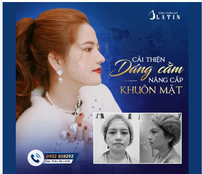 CẢI THIỆN DÁNG CẰM - NÂNG CẤP KHUÔN MẶT