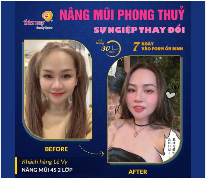 THAY ĐỔI DÁNG MŨI, NHAN SẮC THĂNG HẠNG, SỰ NGHIỆP THĂNG TIẾN