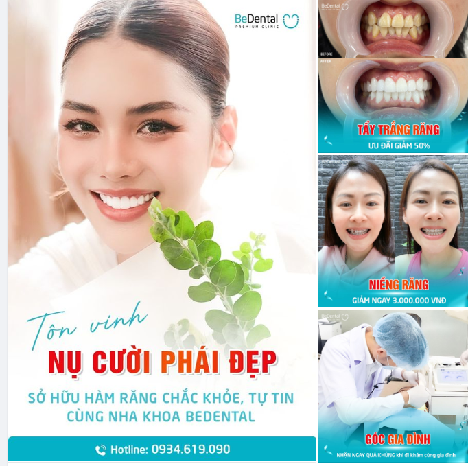 CÙNG BEDENTAL TÔN VINH NỤ CƯỜI PHÁI ĐẸP