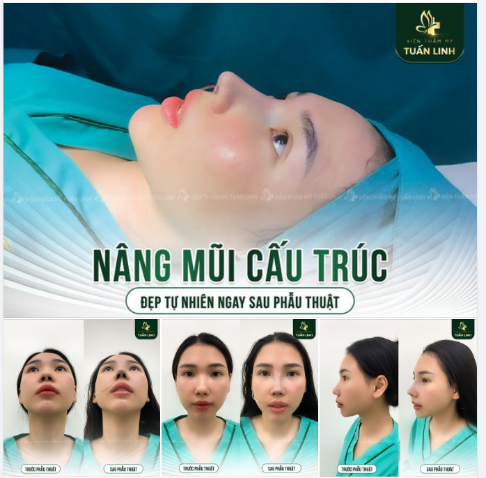 SỞ HỮU CHIẾC MŨI CAO SANG NHƯ KHÁCH HÀNG TUẤN LINH KHÔNG KHÓ