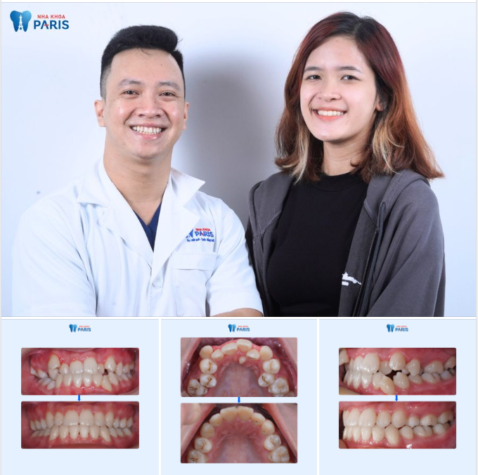 TỰ TIN NỞ NỤ CƯỜI RẠNG RỠ SAU NIỀNG RĂNG