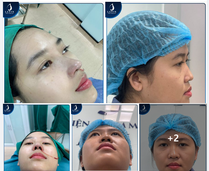 Từ Cần Thơ lên Sài Gòn làm đẹp và cái kết ưng ý