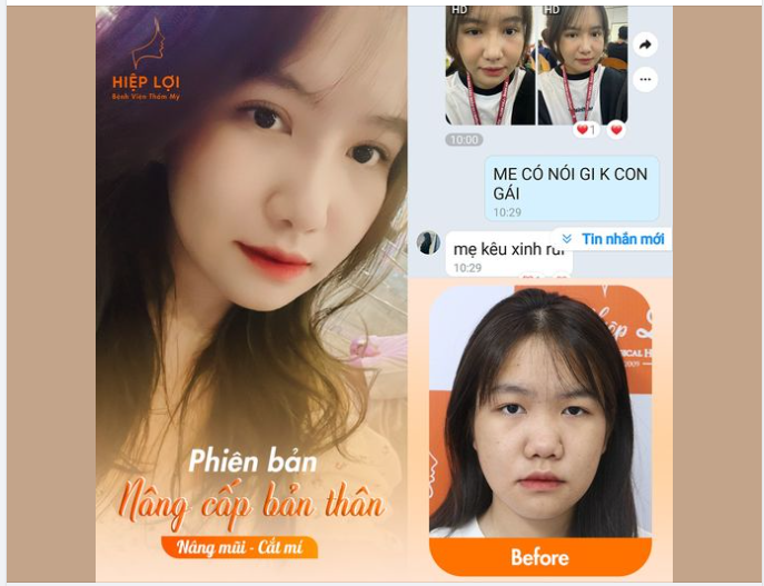 PHIÊN BẢN NÂNG CẤP - ĐẸP NHƯ TỰ NHIÊN