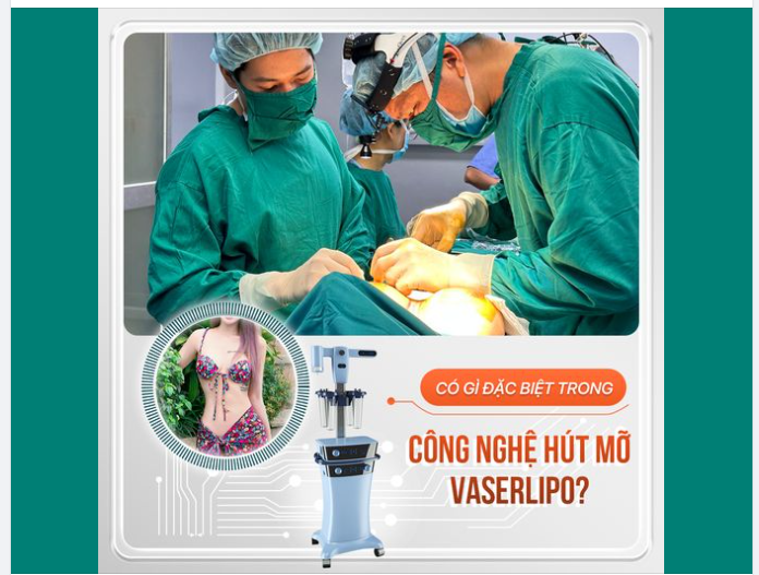 Có gì đặc biệt trong công nghệ hút mỡ Vaserlipo???