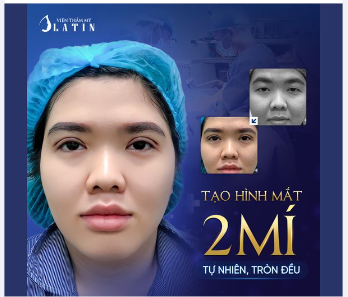Nếu bạn sở hữu đôi mắt một mí bẩm sinh, hãy để Latin giúp bạn tìm thấy đôi mắt 2 mí tự nhiên, tròn đều