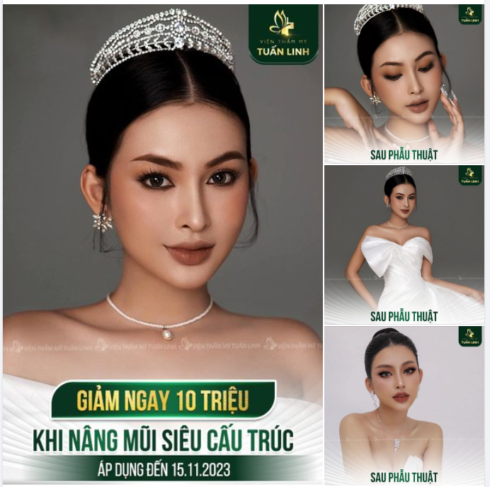 Xinh đẹp không phải may mắn, đó là lựa chọn!