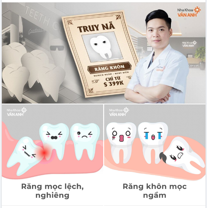 TRUY NÃ ĐỐI TƯỢNG RĂNG KHÔN NGUY HIỂM