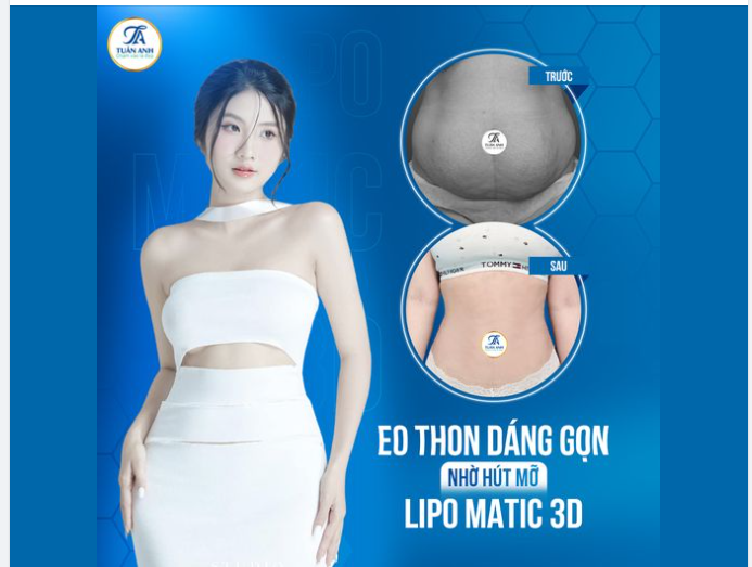 "GỠ" BỎ VÒNG 2 SỒ SỀ - VỀ DÁNG CỰC NGON CHỈ SAU 90P