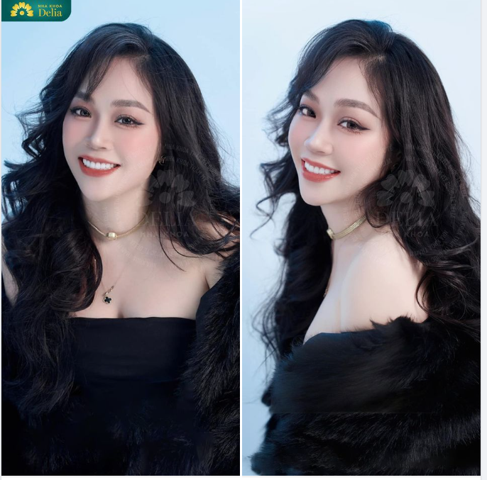 Chân thành cảm ơn chị Lê Thanh đã yêu quý và đồng hành cùng Delia trên hành trình thay đổi nụ cười, làm mới bản thân.