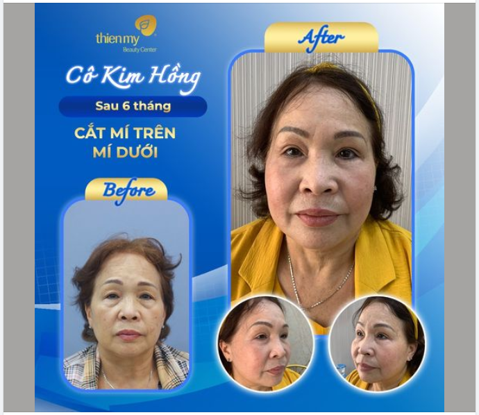 Khách hàng chính là minh chứng cụ thể nhất để FEEBACK chất lượng xịn xò của Thiện Mỹ