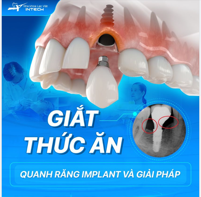 Nỗi đau của công nghệ cũ đã được chữa lành