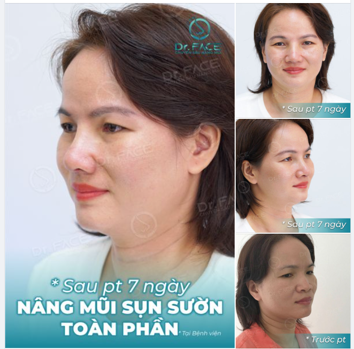 Những thứ mình thích, tại sao phải hỏi người khác có đẹp không?