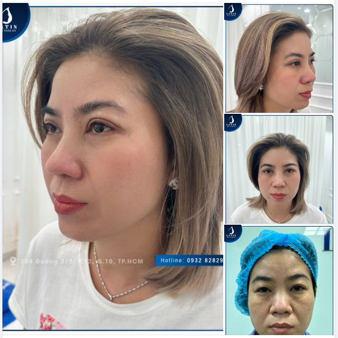 Nhan sắc nâng cấp chỉ sau 10 ngày