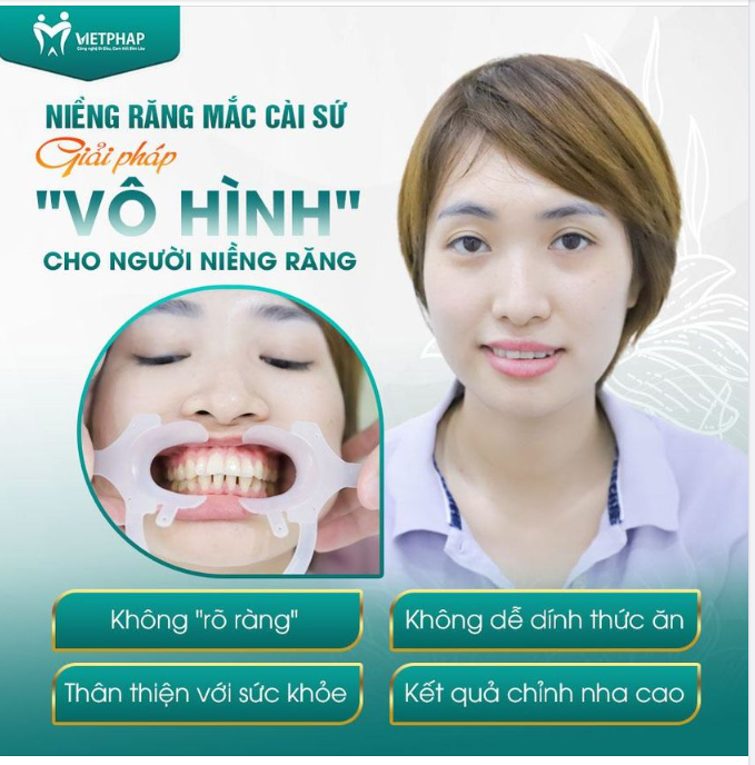 NIỀNG RĂNG MẮC CÀI SỨ - GIẢI PHÁP THẨM MỸ CHO NGƯỜI NIỀNG RĂNG