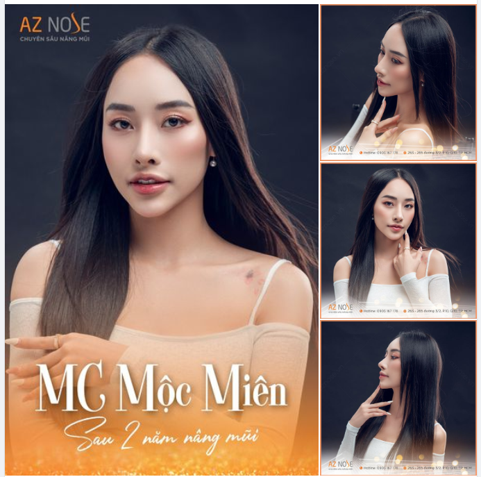 Xinh đẹp không phải may mắn, đó là lựa chọn!