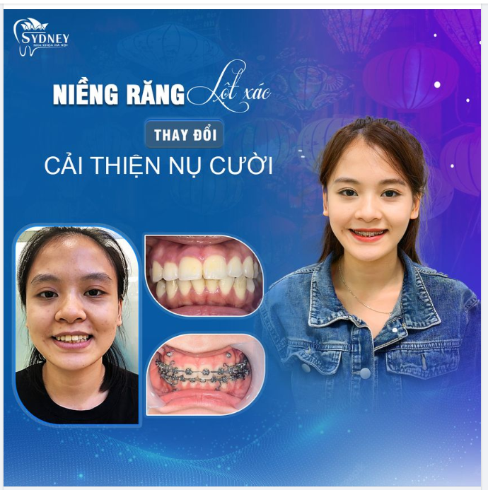 NHA KHOA HÀ NỘI SYDNEY MỪNG TẾT TRUNG THU 2023