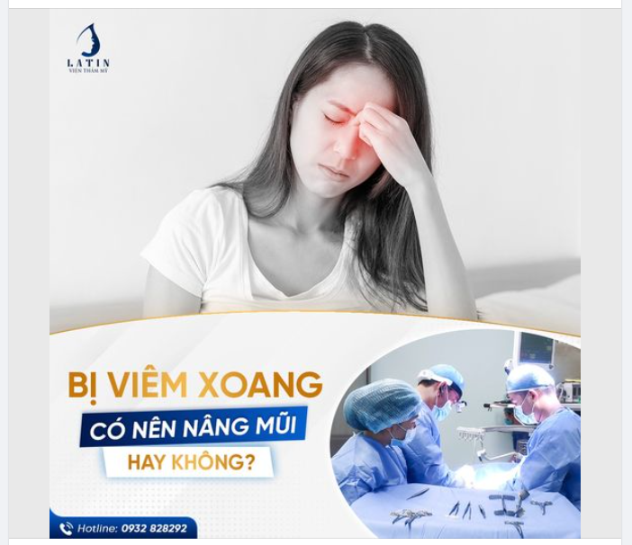 Bị viêm xoang có nên nâng mũi không?