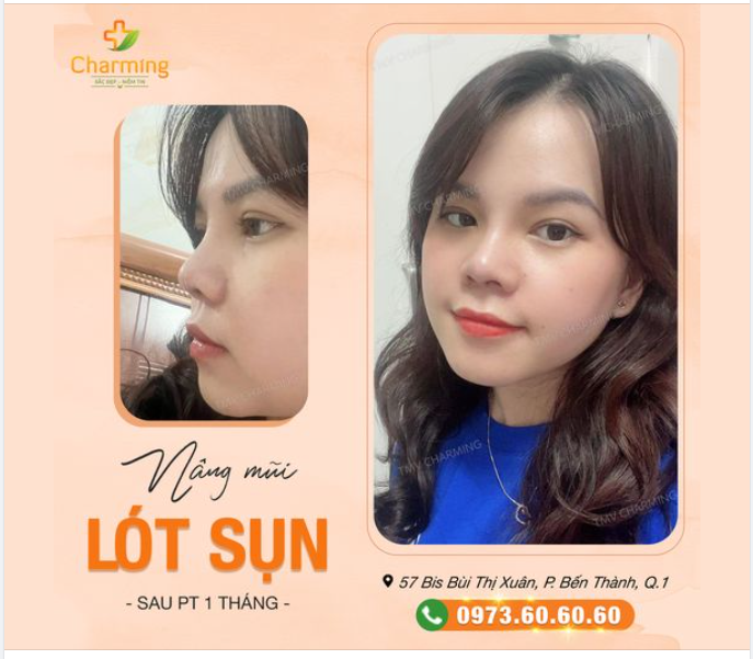 Áo xanh môi đỏ cho em nhỏ nó mừng